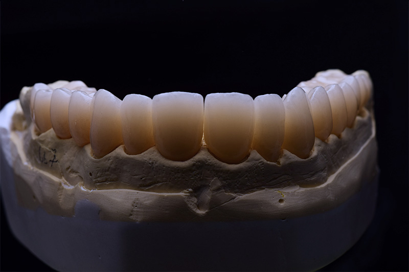 fabio-persegani-reabilitacao-oral-01