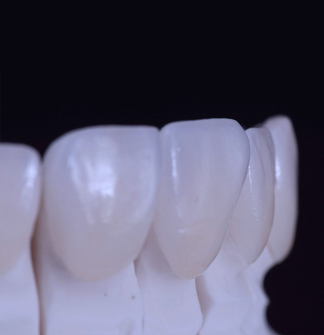 fabio-persegani-reabilitacao-oral-04-(7)
